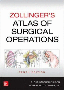 ZOLLINGERS ATLAS OF SURGICAL OPERATIONS