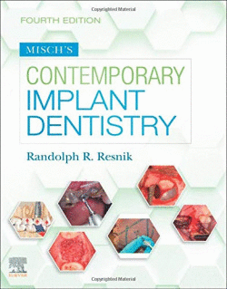 MISCH`S CONTEMPORARY IMPLANT DENTISTRY
