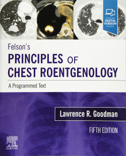 FELSON`S PRINCIPLES OF CHEST ROENTGENOLOGY A PROGRAMMED