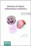 AVANCES EN LUPUS ERITEMATOSO SISTMICO