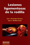 LESIONES LIGAMENTOSAS DE RODILLA