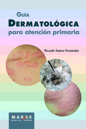 GU�A DERMATOL�GICA PARA ATENCI�N PRIMARIA