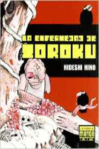LA ENFERMEDAD DE ZOROKU