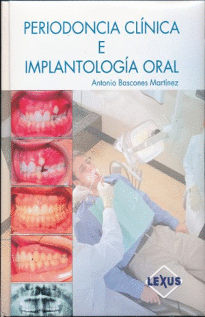 BASCONES PERIODONCIA CLINICA E IMPLANTOLOGIA 4TA EDICION