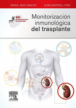 MONITORIZACI�N INMUNOL�GICA DEL TRASPLANTE