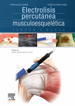 ELECTROLISIS PERCUT�NEA MUSCULOESQUEL�TICA. TEND�N Y BURSA
