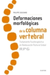 DEFORMACIONES MORFOL�GICAS DE LA COLUMNA VERTEBRAL