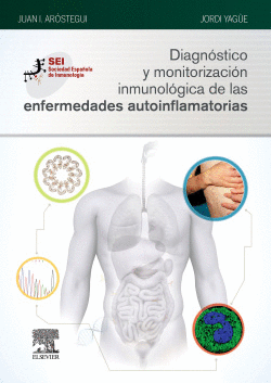 DIAGN�STICO Y MONITORIZACI�N INMUNOL�GICA DE LAS ENFERMEDADES AUTOINFLAMATORIAS
