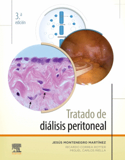 TRATADO DE DI�LISIS PERITONEAL (3� ED.)