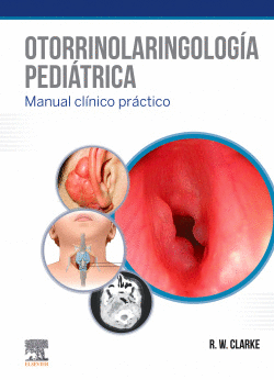 OTORRINOLARINGOLOG�A PEDI�TRICA
