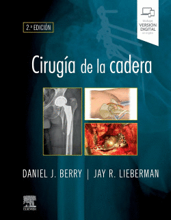 CIRUGIA DE LA CADERA 2� ED