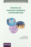 AVANCES EN ESCLEROSIS SIST�MICA (ESCLERODERMIA)