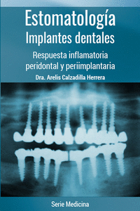 ESTOMATOLOG�A. IMPLANTES DENTALES